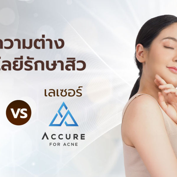 วัดความต่าง เทคโนโลยีรักษาสิว เลเซอร์ AviClear vs เลเซอร์ Accure